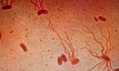 Ancient Killer Is Rapidly Gaining Resistance to Antibiotics, Scientists Warn : ScienceAlert