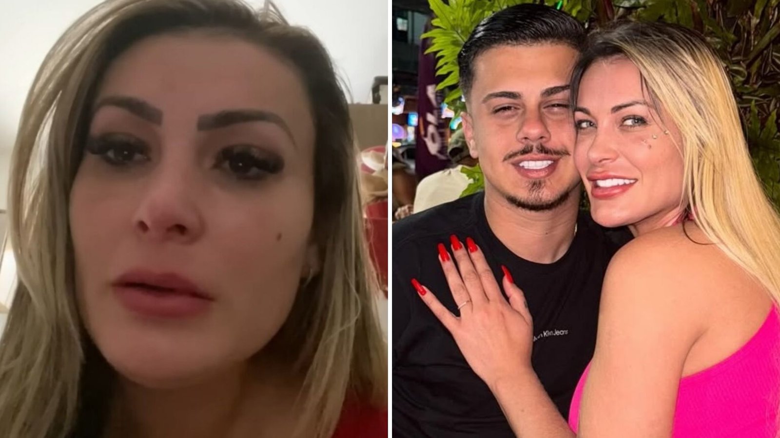 Andressa Urach voltou a ser virgem? Entenda a cirugia íntima feita pela influencer