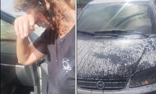 Mulher é atingida por piche no rosto durante obras na BR-277 na RMC