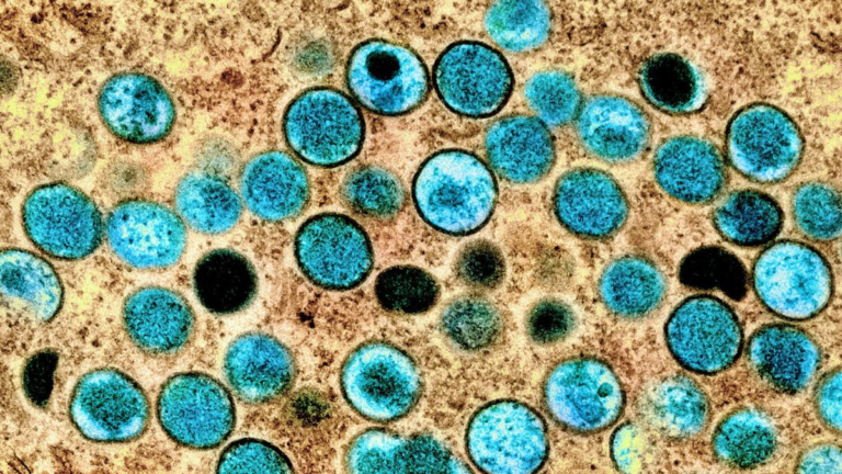Vírus Mpox já atinge 13 estados do Brasil e Ministério da Saúde faz recomendações urgentes