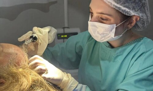 Calvície tem tratamento pelo SUS; hospital no Paraná é referência