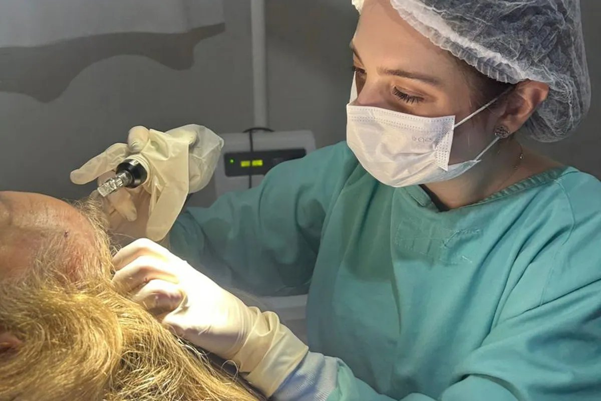 Calvície tem tratamento pelo SUS; hospital no Paraná é referência