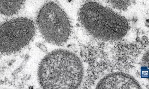 DOH detected Mpox in Oahu wastewater sample
