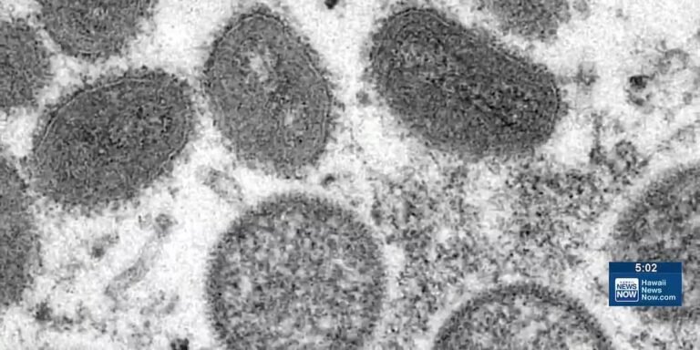 DOH detected Mpox in Oahu wastewater sample