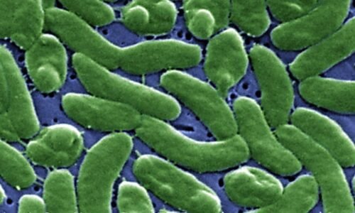 Flesh-eating bacteria that could kill in 2 days found in Long Island waters: report