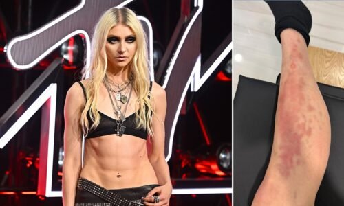 Taylor Momsen hospitalized after venomous spider bite on Mexico tour