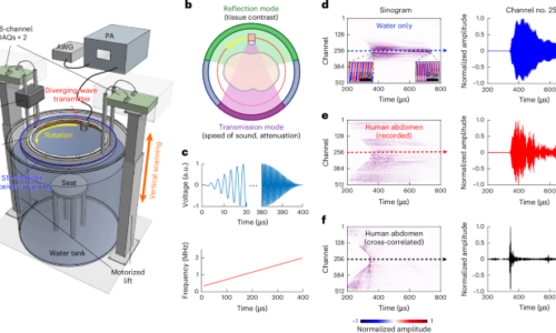 Whole cross-sectional human ultrasound tomography