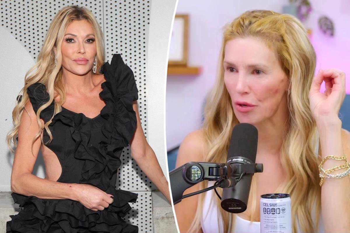 Brandi Glanville thinks she has a 'sexually transmitted ringworm' in her throat
