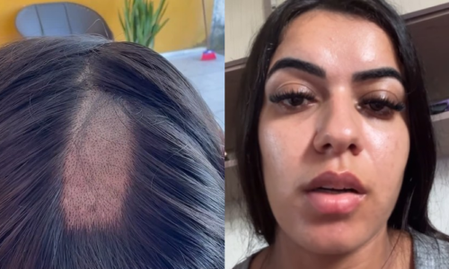 Mulher denuncia clínica após ter cabelo raspado em exame toxicológico para CNH